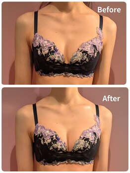 ククナ 上越店(KUKUNA)/★バストアップビフォーアフター