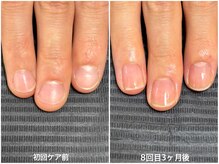 エムズ(m's)/【自爪育成】３ヶ月コース