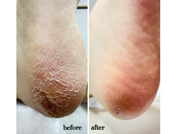 ラヴィ(La vie)/これからの季節にぴったり！