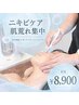 【新規★アクネケア*肌荒れ集中】毛穴洗浄×ピーリング×トーニング¥8,900