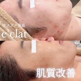 エクレ(eclat)