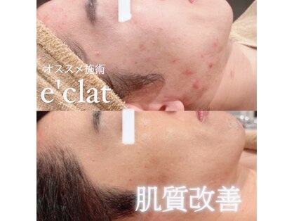 エクレ(eclat)の写真