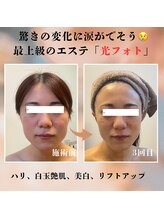 ママニエ(ma maniere)/究極のエイジングケア光フォト