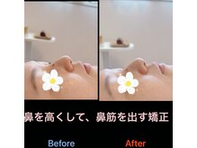 美容矯正サロン レレポノ(LELEPONO)/