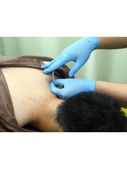 鍼灸施術を受けたい