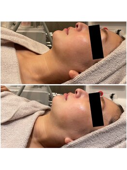 ビュウナ 銀座(BEAUNA)/シルクブライト