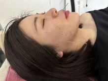 ナノフェイス 名古屋駅前店(nano face)