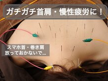 スプリング鍼灸院(Spring鍼灸院)の雰囲気（頑固な首肩こりでお悩みの方、当院の全身鍼で改善しませんか？）