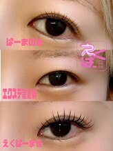 アリラアイ(ALiLa eye)/えくぱーま