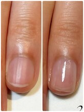 ミリアネイル 成城(Miliea nail)/