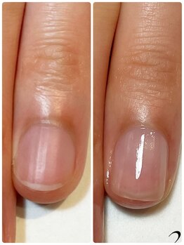 ミリアネイル 成城(Miliea nail)/