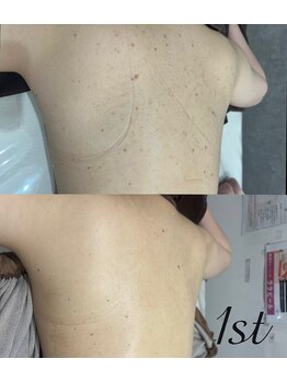 ファースト(1st)/