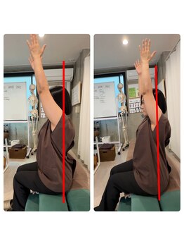 香椎井上整骨 整体院/肩こり・首こり・頭痛を根本改善