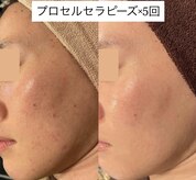 【プロセルセラピーズ認定店 &nbsp;plage】毛穴ケア/育毛/更年期/デトックス