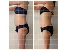 アイリーボーテ 東大阪(アイリーBEAUTE)の雰囲気(50代/キャビテーション/ラジオ波/マッサージ )