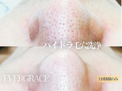 エヴァーグレース 栄店の写真