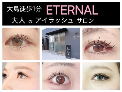 エターナルの写真