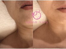 サロンヴェアリー 広尾(salon vary)/首のケアも！！