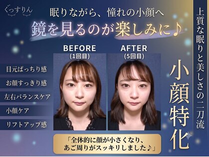 ぐっすりんの写真