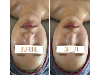 小顔コルギサロン シー(She)/【コルギ】1度の変化!