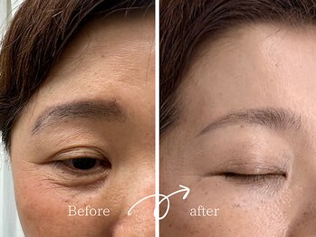 レディゴー(LADY GO)/すっきり美眉に♪