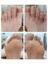 リゼランアンドコー 福島鎌田店(LIZERA&Co)/トータルフットキュア