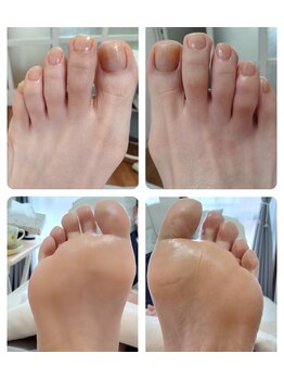 リゼランアンドコー 福島鎌田店(LIZERA&Co)/トータルフットキュア