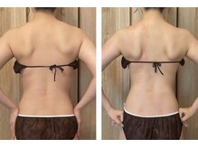 チェリッシュ(cherish)/肩甲骨剥がしで華奢見せ背中に