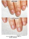 最強のネイルケア３ケ月間コース