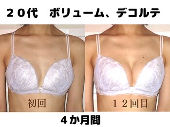 バストサロン メルベイユ(Merveile)/全体ボリュームUP・谷間クッキリ