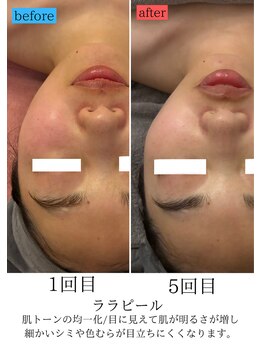 ユフラ(Juhla)/ララピール