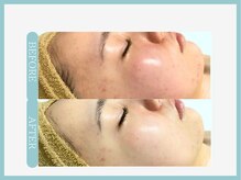 スリムライン 青森店(The Slim Line)/before→after