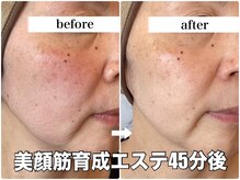 リエル(RIEL)/小顔矯正×美顔筋育成エステ