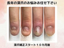 エルナ(elna)の雰囲気（幼い頃から悩んでいた深爪も、しっかりサポートさせて頂きます）