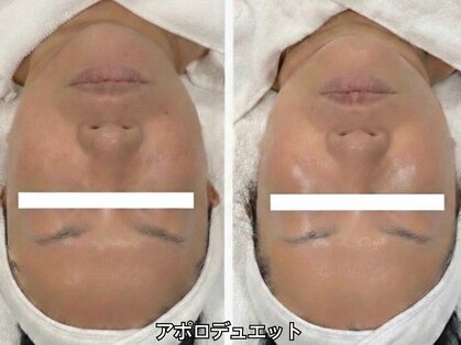 シャンディ(Shandy)の写真