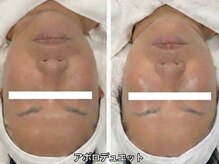 シャンディ(Shandy)