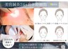 【特★再来】生ヒト幹細胞+24本鍼通電★弛み/毛穴/小顔/くすみ★最強肌管理