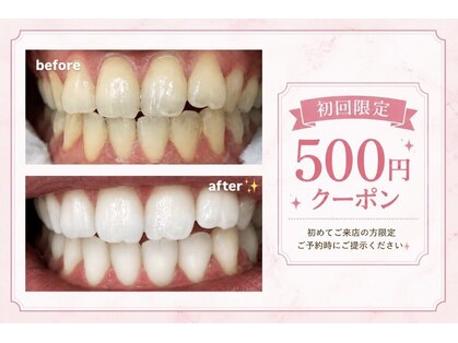 セルフホワイトニングサロン エクシアホワイトニング 自由が丘店の写真