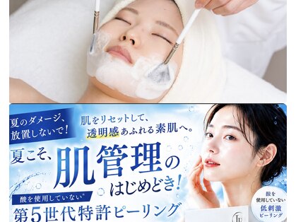 リチャーム(Recharm)の写真