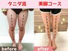 【下半身太り撃退に特化】痩身美容整体&痩身マシーンで美脚メイク初回コース