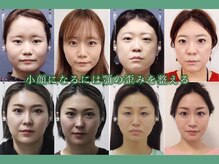 さつま骨格矯正 広尾 西麻布院 