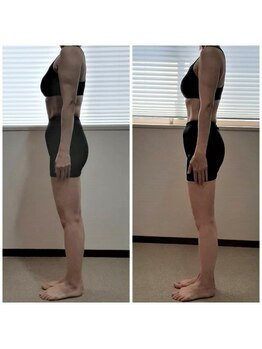 ウィルビーアシヤ(Will be ASHIYA)/モニター様1-横/40代