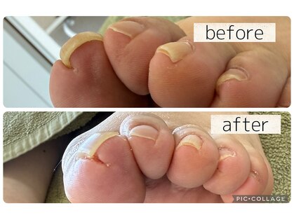 ベーネ(bene)の写真