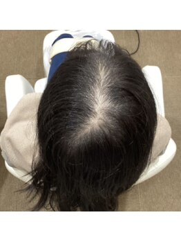 エルプラス(L+)/20代女性.2