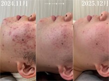 プライベートサロン ラウレア(Laule'a)/ハーブリプロ