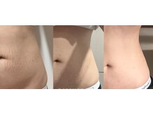 ニュイブラーシュ(nuit blanche)の雰囲気（レモンボトルとレッドショットを使い分け夢のボディラインと美肌）