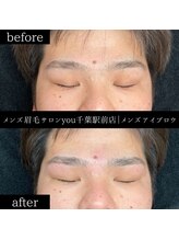 ユー 千葉駅前店(you)/ビフォ－アフター写真