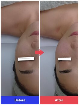 ルミナリー 仙台五橋(luminary)/オーダメイドフェイシャル