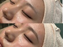 ブルームスアンジュ(Blooms Unge)/眉毛ワックス、ブローマッピング