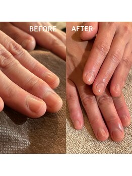 ビビィ(vivie)/手足のお悩み、お聞かせください